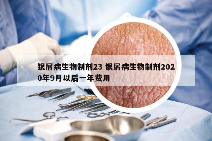 银屑病生物制剂23 银屑病生物制剂2020年9月以后一年费用
