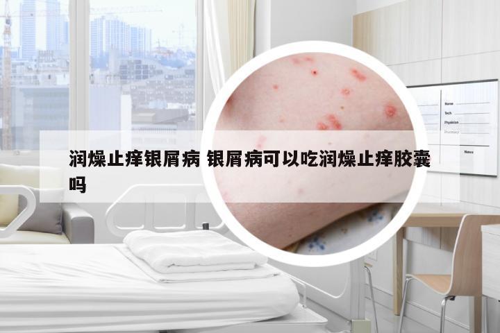 润燥止痒银屑病 银屑病可以吃润燥止痒胶囊吗