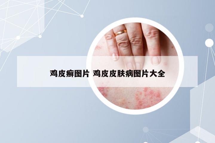 鸡皮癣图片 鸡皮皮肤病图片大全