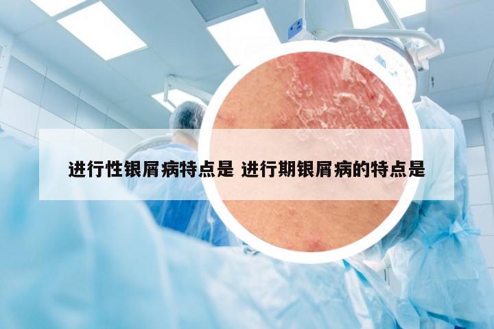 进行性银屑病特点是 进行期银屑病的特点是