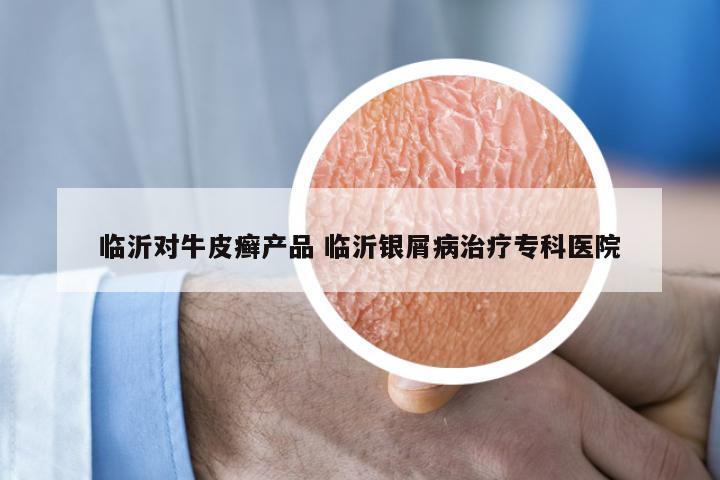 临沂对牛皮癣产品 临沂银屑病治疗专科医院