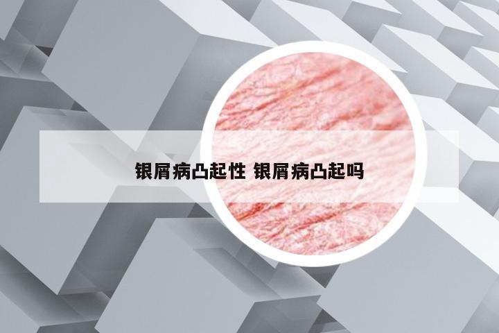 银屑病凸起性 银屑病凸起吗