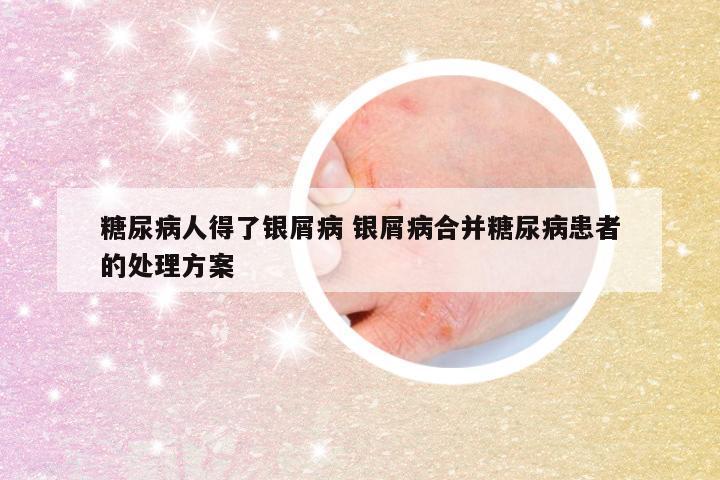 糖尿病人得了银屑病 银屑病合并糖尿病患者的处理方案