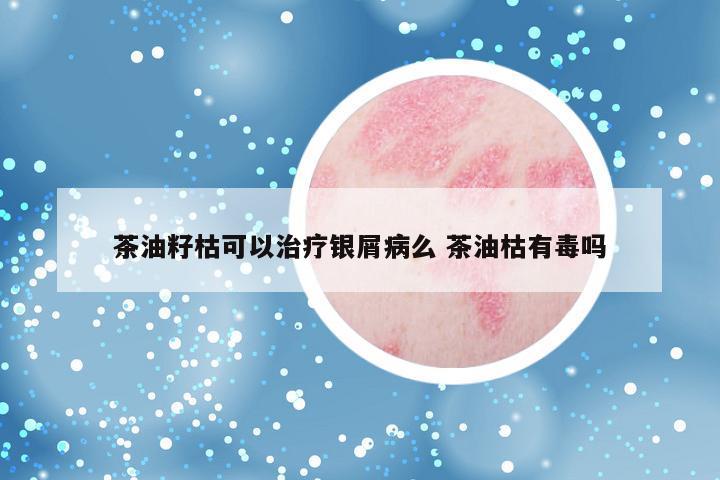 茶油籽枯可以治疗银屑病么 茶油枯有毒吗