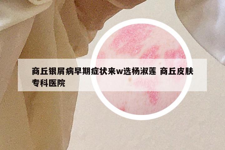 商丘银屑病早期症状来w选杨淑莲 商丘皮肤专科医院