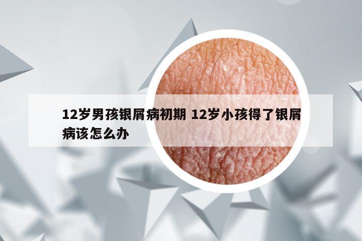 12岁男孩银屑病初期 12岁小孩得了银屑病该怎么办