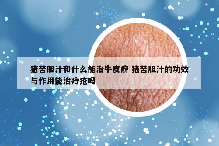 猪苦胆汁和什么能治牛皮癣 猪苦胆汁的功效与作用能治痔疮吗