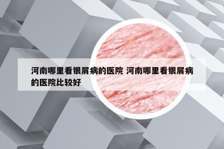 河南哪里看银屑病的医院 河南哪里看银屑病的医院比较好