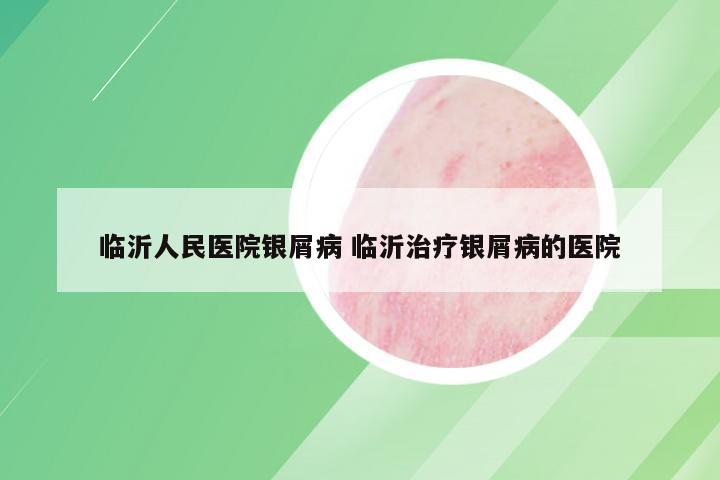 临沂人民医院银屑病 临沂治疗银屑病的医院