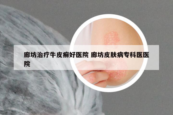 廊坊治疗牛皮癣好医院 廊坊皮肤病专科医医院
