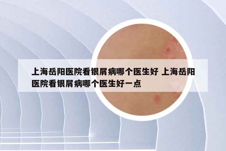 上海岳阳医院看银屑病哪个医生好 上海岳阳医院看银屑病哪个医生好一点