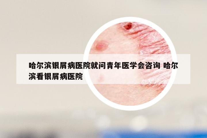 哈尔滨银屑病医院就问青年医学会咨询 哈尔滨看银屑病医院