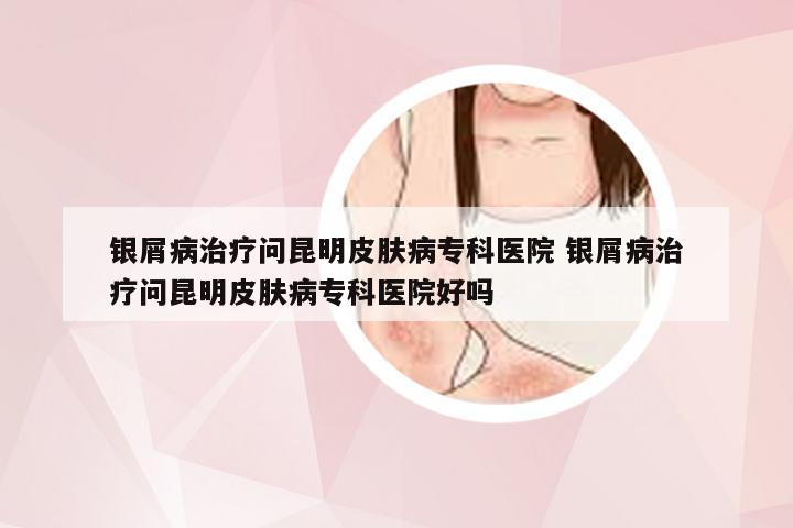 银屑病治疗问昆明皮肤病专科医院 银屑病治疗问昆明皮肤病专科医院好吗