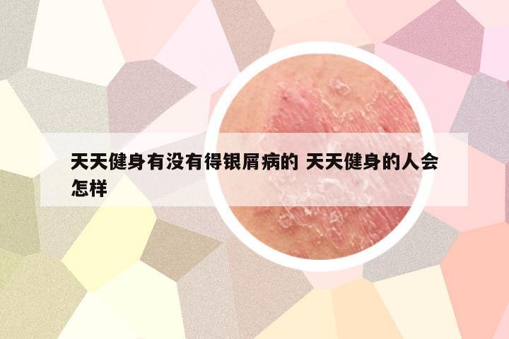 天天健身有没有得银屑病的 天天健身的人会怎样