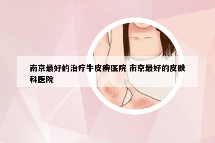南京最好的治疗牛皮癣医院 南京最好的皮肤科医院