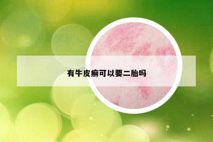 有牛皮癣可以要二胎吗