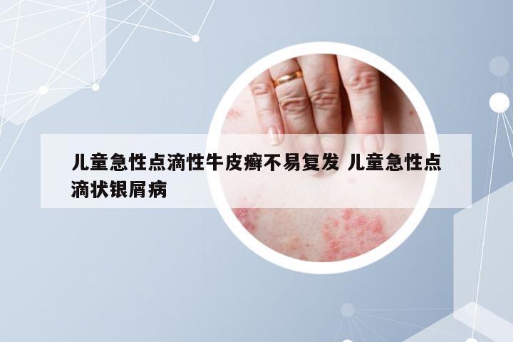 儿童急性点滴性牛皮癣不易复发 儿童急性点滴状银屑病