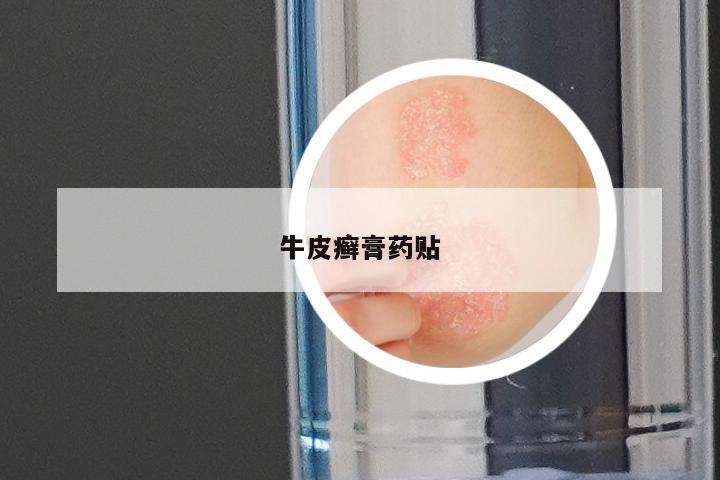 牛皮癣膏药贴