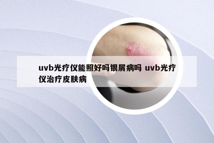 uvb光疗仪能照好吗银屑病吗 uvb光疗仪治疗皮肤病