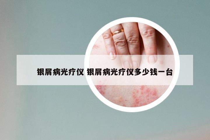 银屑病光疗仪 银屑病光疗仪多少钱一台