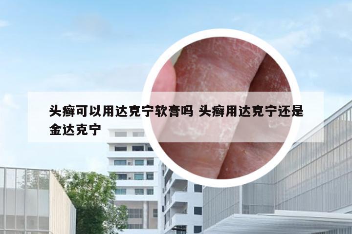 头癣可以用达克宁软膏吗 头癣用达克宁还是金达克宁