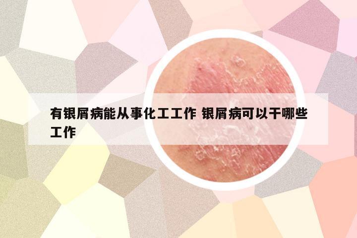 有银屑病能从事化工工作 银屑病可以干哪些工作