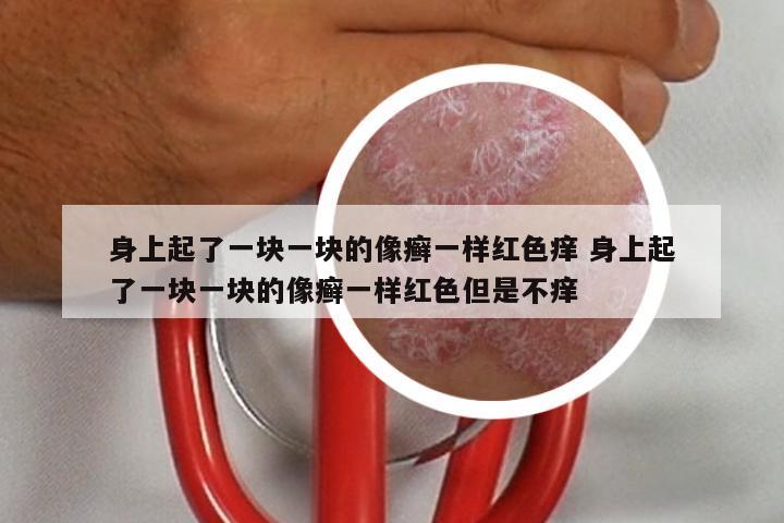 身上起了一块一块的像癣一样红色痒 身上起了一块一块的像癣一样红色但是不痒