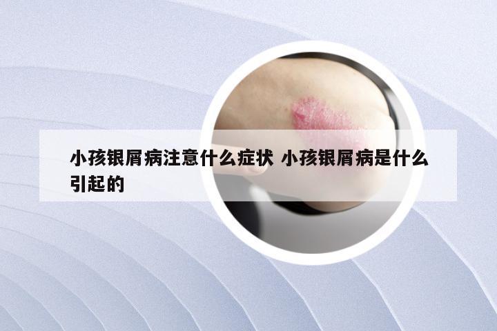 小孩银屑病注意什么症状 小孩银屑病是什么引起的