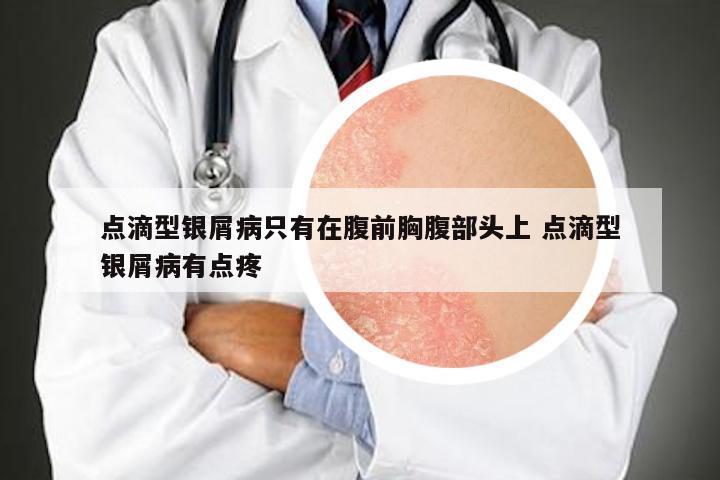 点滴型银屑病只有在腹前胸腹部头上 点滴型银屑病有点疼