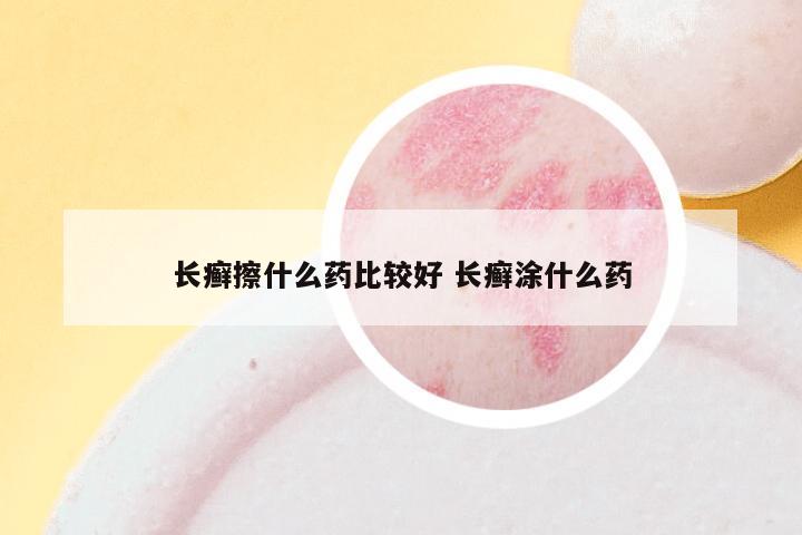 长癣擦什么药比较好 长癣涂什么药