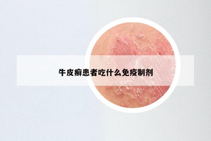 牛皮癣患者吃什么免疫制剂