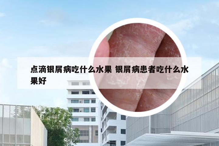点滴银屑病吃什么水果 银屑病患者吃什么水果好