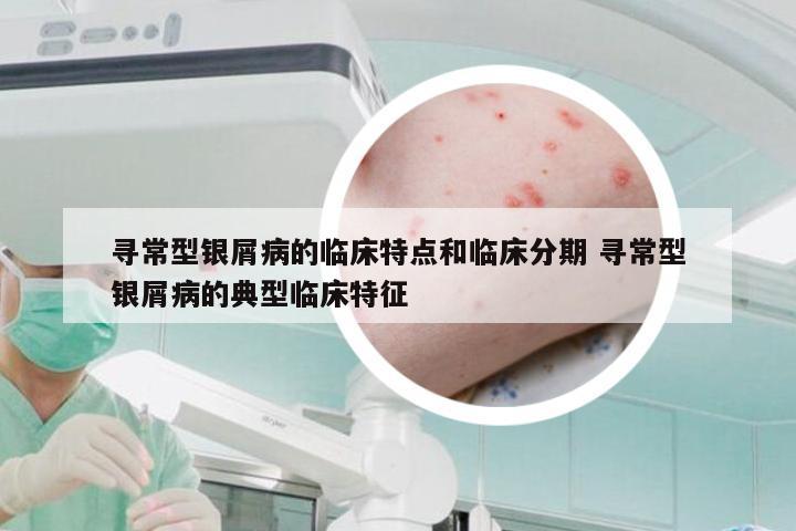 寻常型银屑病的临床特点和临床分期 寻常型银屑病的典型临床特征