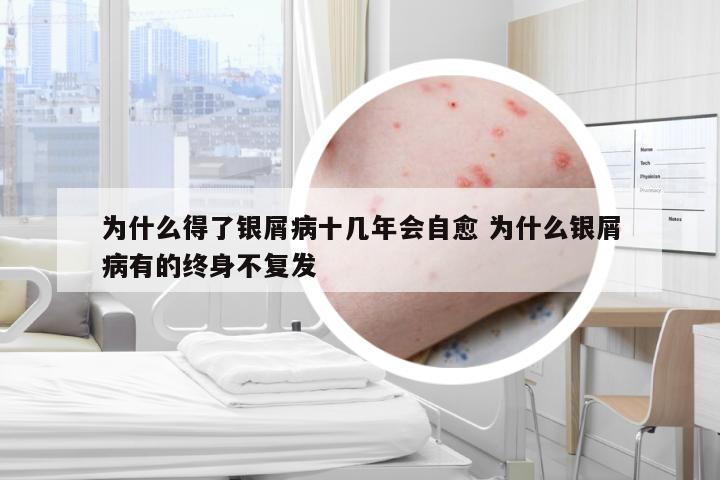为什么得了银屑病十几年会自愈 为什么银屑病有的终身不复发