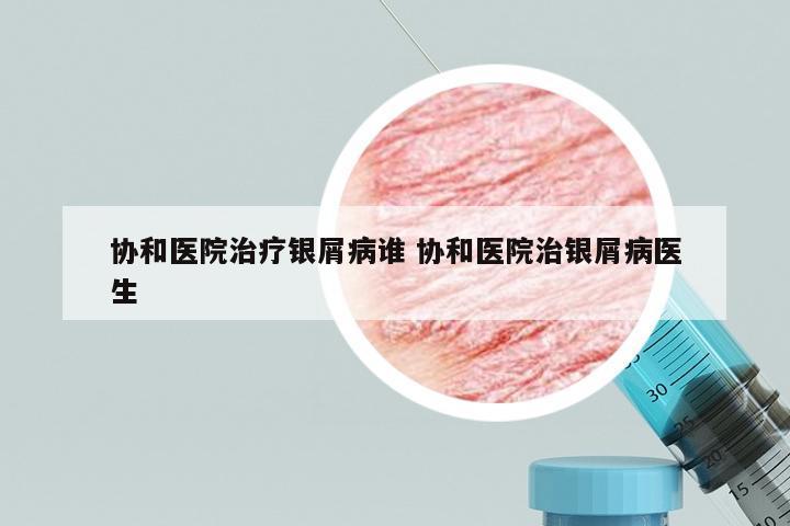 协和医院治疗银屑病谁 协和医院治银屑病医生