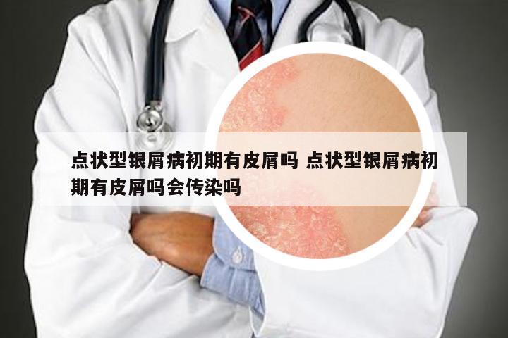 点状型银屑病初期有皮屑吗 点状型银屑病初期有皮屑吗会传染吗