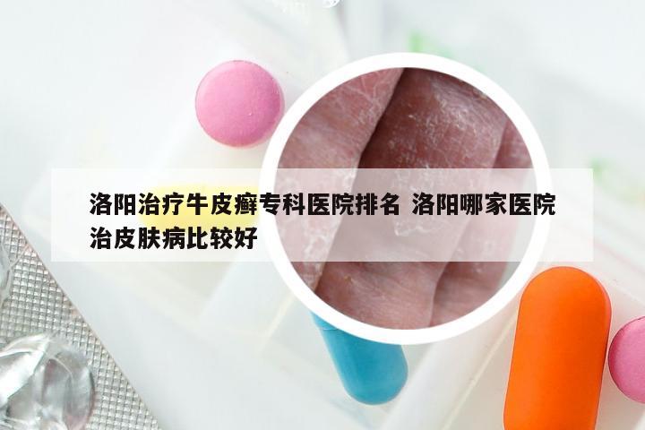 洛阳治疗牛皮癣专科医院排名 洛阳哪家医院治皮肤病比较好