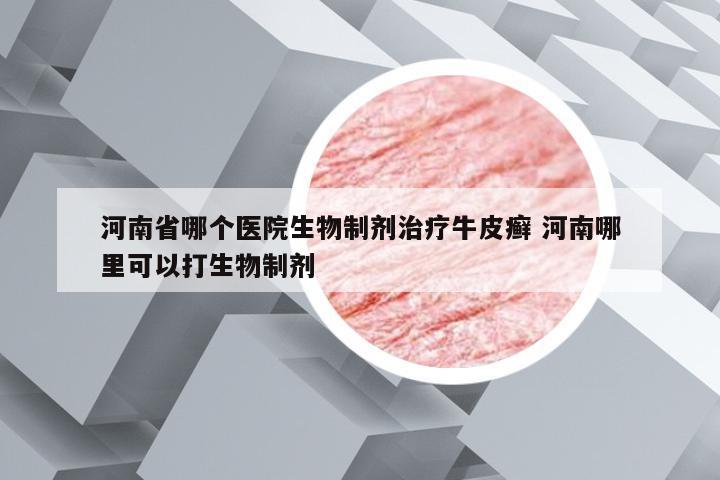 河南省哪个医院生物制剂治疗牛皮癣 河南哪里可以打生物制剂