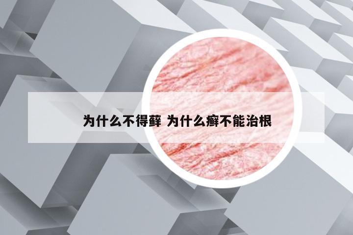 为什么不得藓 为什么癣不能治根