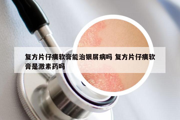 复方片仔癀软膏能治银屑病吗 复方片仔癀软膏是激素药吗