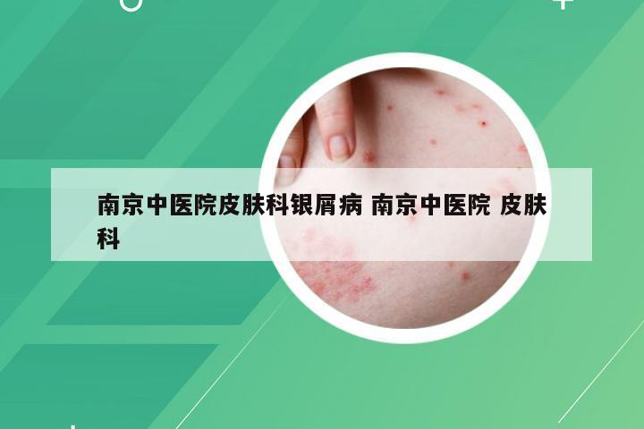 南京中医院皮肤科银屑病 南京中医院 皮肤科