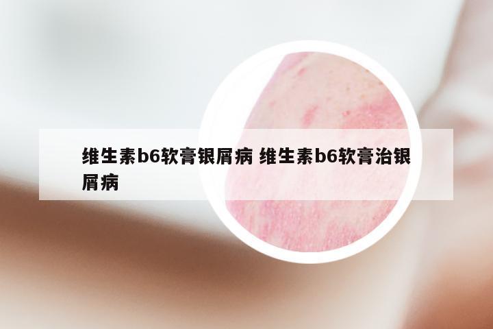 维生素b6软膏银屑病 维生素b6软膏治银屑病