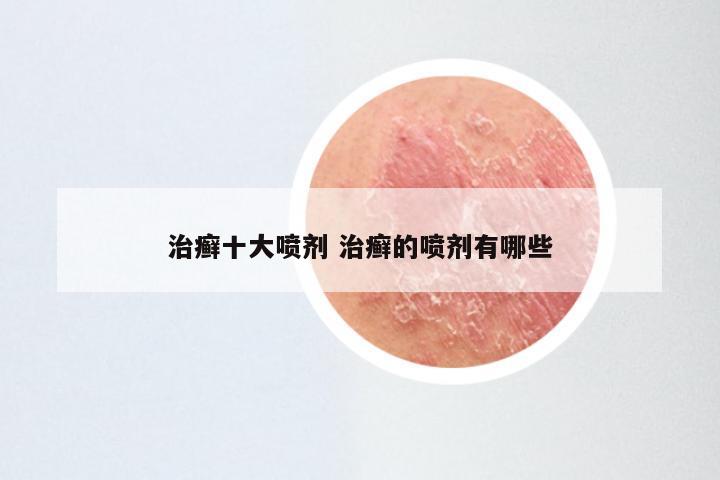 治癣十大喷剂 治癣的喷剂有哪些