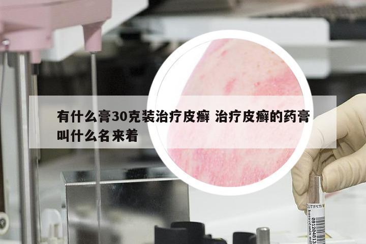 有什么膏30克装治疗皮癣 治疗皮癣的药膏叫什么名来着