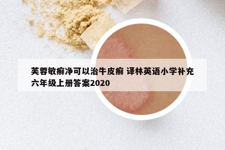 芙蓉敏癣净可以治牛皮癣 译林英语小学补充六年级上册答案2020