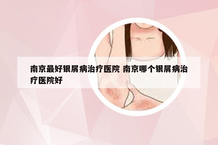 南京最好银屑病治疗医院 南京哪个银屑病治疗医院好