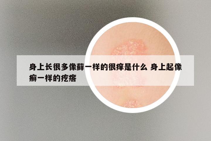 身上长很多像藓一样的很痒是什么 身上起像癣一样的疙瘩