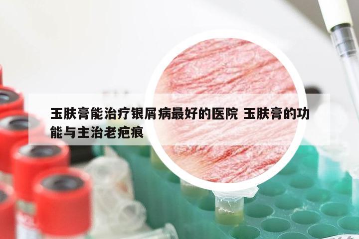 玉肤膏能治疗银屑病最好的医院 玉肤膏的功能与主治老疤痕