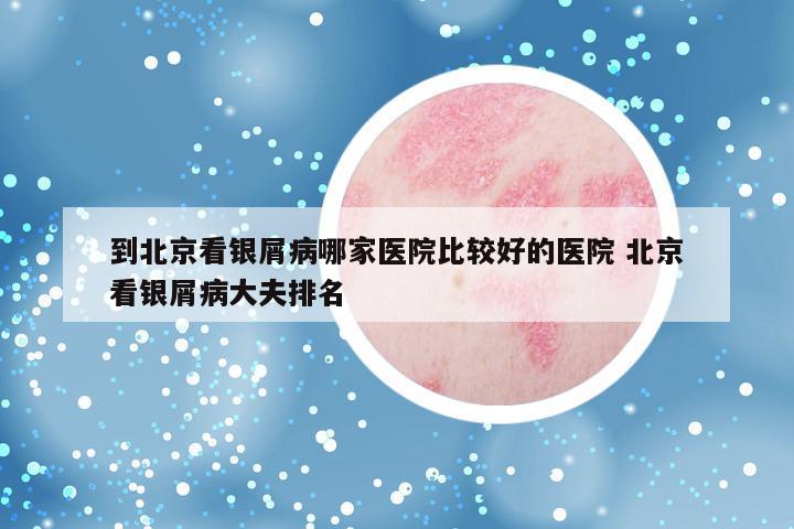 到北京看银屑病哪家医院比较好的医院 北京看银屑病大夫排名