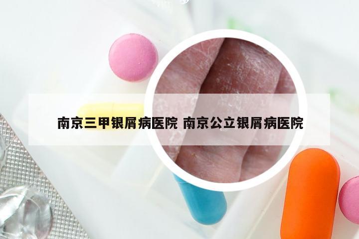 南京三甲银屑病医院 南京公立银屑病医院